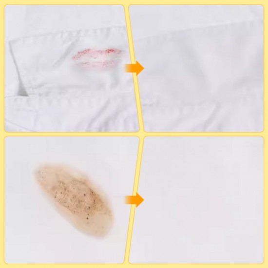 Letzter Tag der Aktion - KAUF 1 BEKOMME 1 GRATIS!Tragbarer Sofort-Leave-In Fleckenentferner-Stift